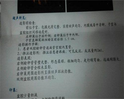 痔疮便血对试管移植的影响及应对策略