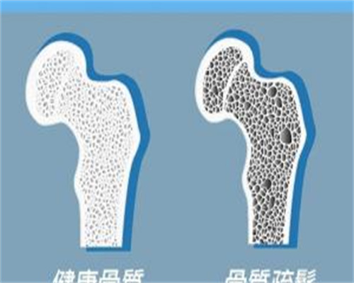 促排卵针用量调整指南:私人助孕服务中的剂量优化策略